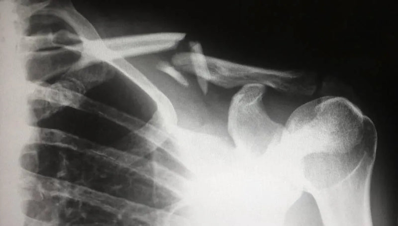 Why Most Sports Injuries Happen
